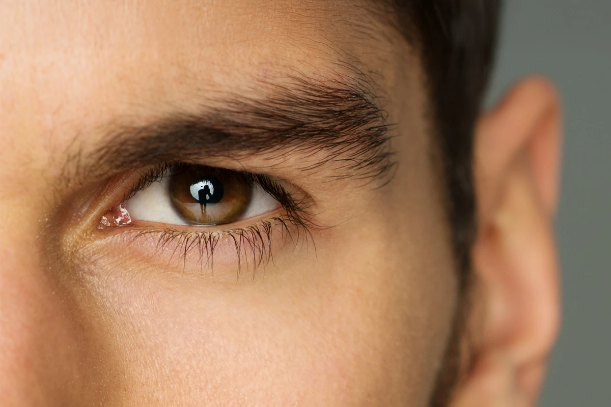 Cosmetic and Reconstructive Eyelid Surgery - Northern Beaches