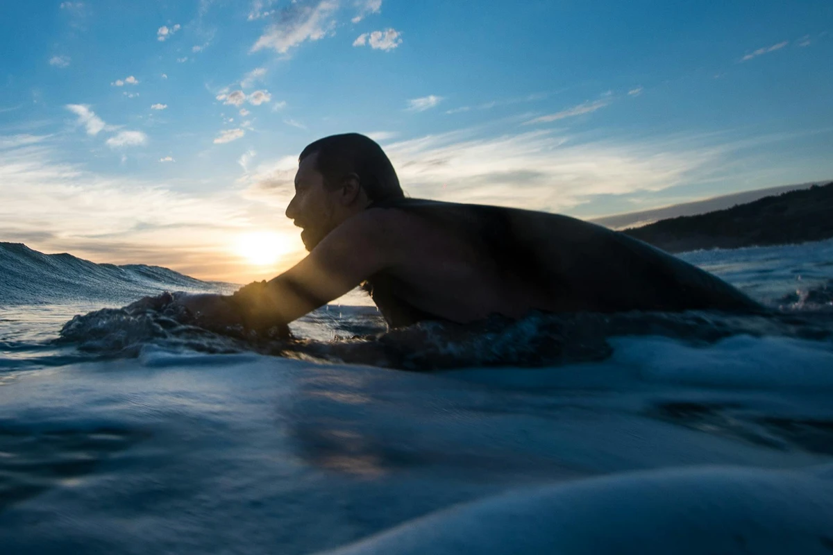 Surgery for pterygium