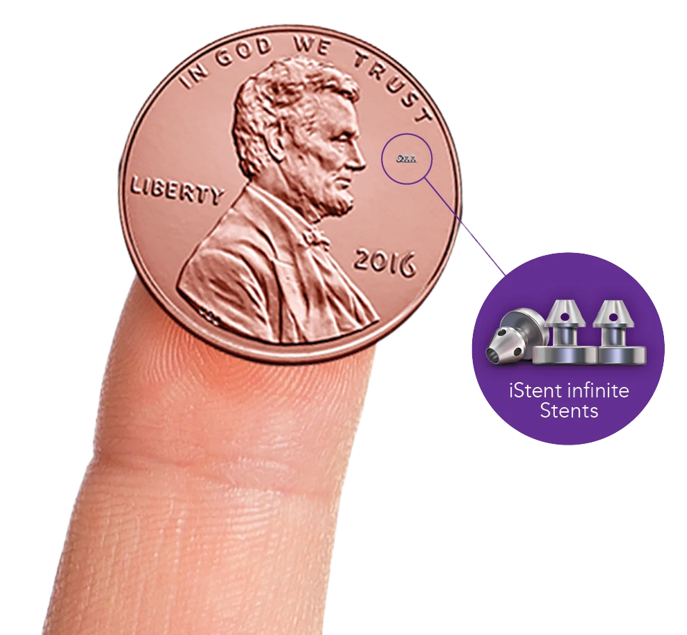 Comparison of iStent size compared to a US penny coin
